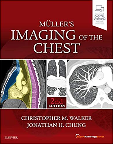 Muller's Imaging of the Chest (2nd Edition)